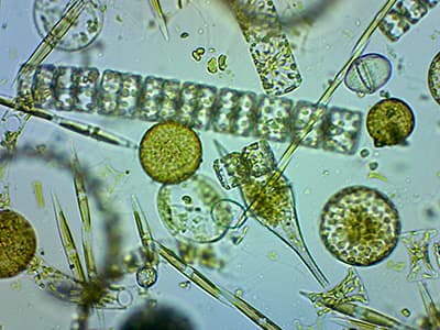 plankton under a microscope
