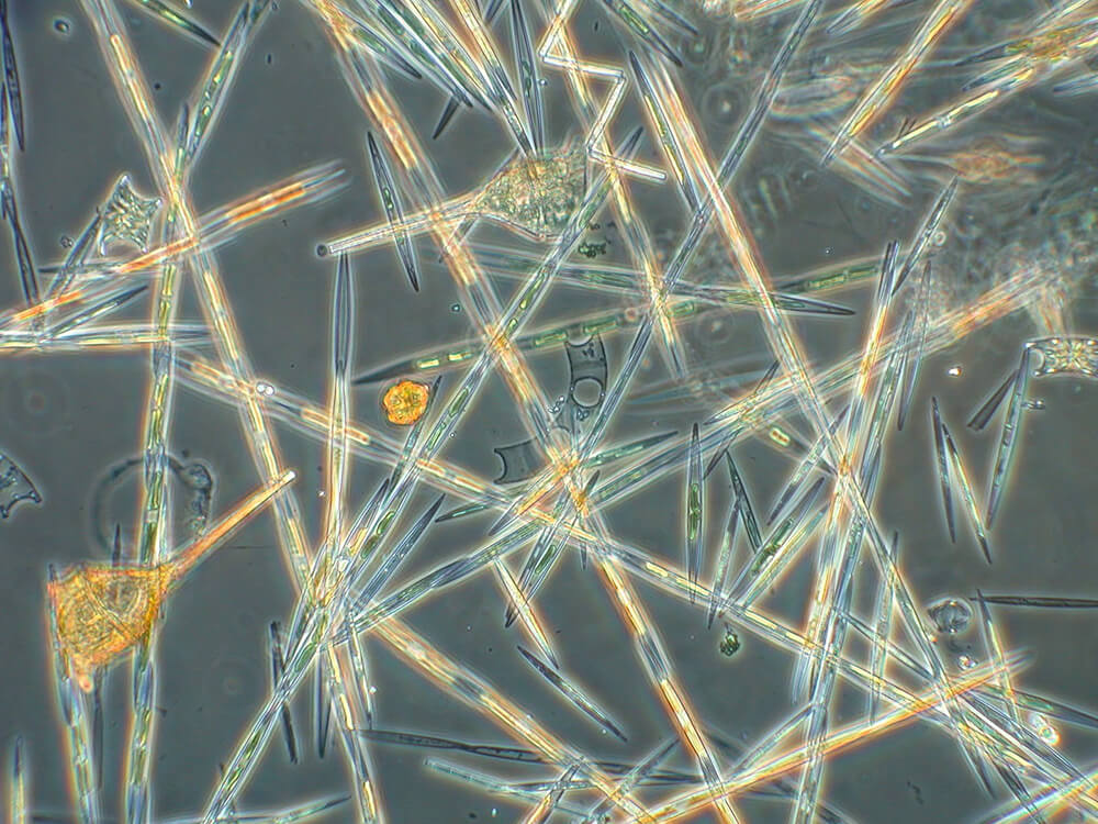 Translucent, rod-like structures, magnified by a microscope.